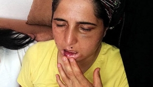 Kocasından 22 yıldır işkence gördi