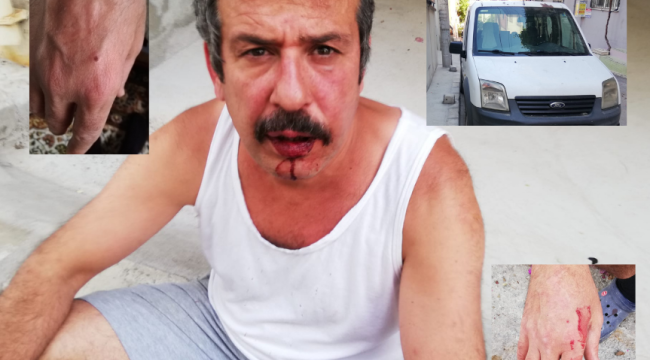 ARACI YİNE AYNI YERE PARK ETTİLER:''SALDIRGAN KARI-KOCANIN TAHRİKLERİ SÜRÜYOR'